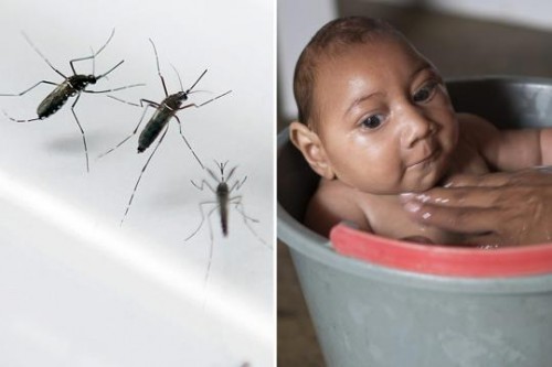 Zika Virus Disease