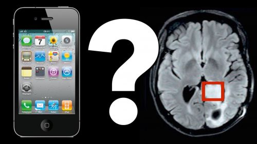 Mobile phones cause brain cancer