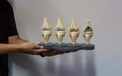 Why to get knee issues checked out by bone and joint specialists in Melbourne