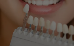 Aesthetic Solutions: Exploring Dentures and Veneers