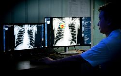 VinBrain and Global Fund continue joining forces to tackle Vietnam’s tuberculosis challenge through AI in 2024