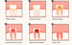 The Importance of Regular Dental Check-Ups: Preventing Problems Before They Start