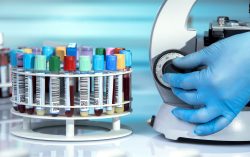 Precision Matters: Laboratory Equipment Calibration Explained