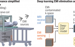 Breakthrough in 0.05 Tesla MRI reported by HKU Engineering team in Science Journal